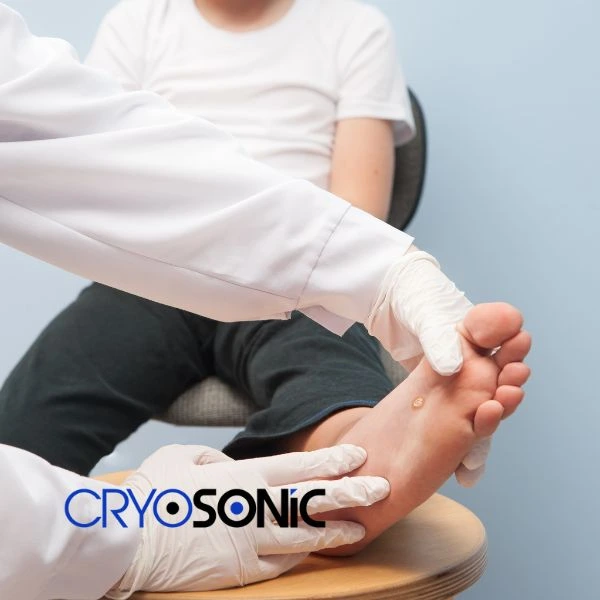 Are you looking for fast effective wart removal Contact us today Barking